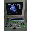 ultrasound machine price and ultrasound machine for pregnancy